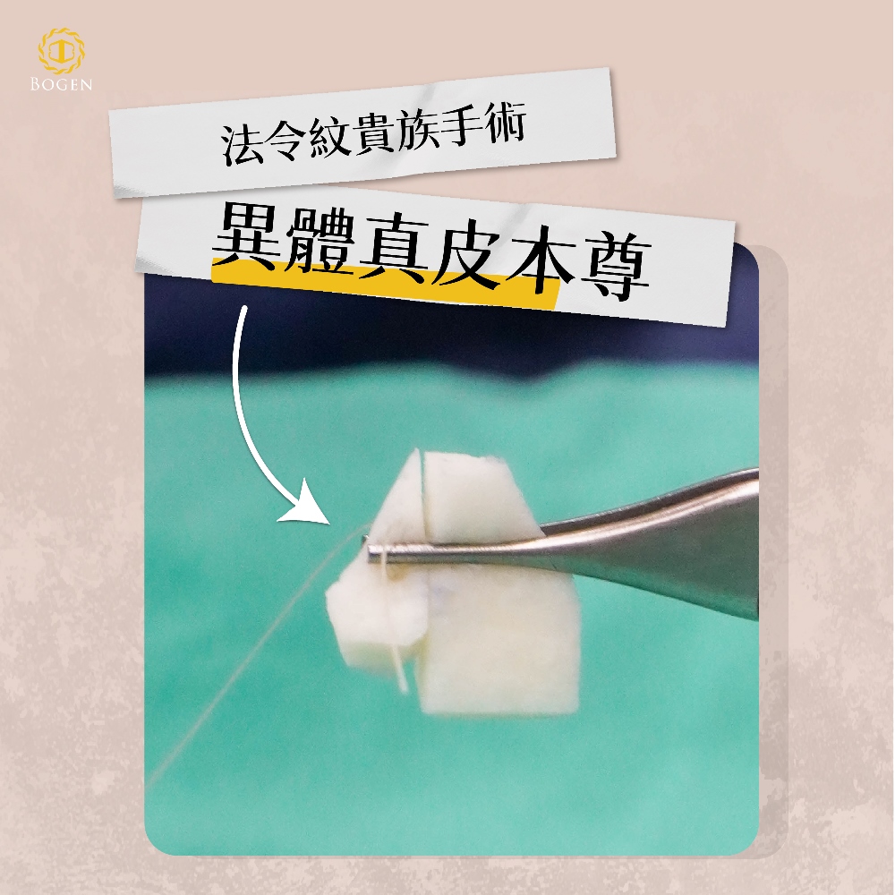 異體真皮,法令紋貴族手術,博恩妍